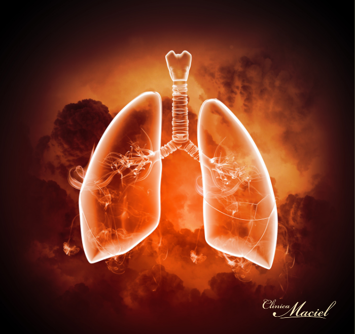 BRONQUIOLITE VIRAL AGUDA